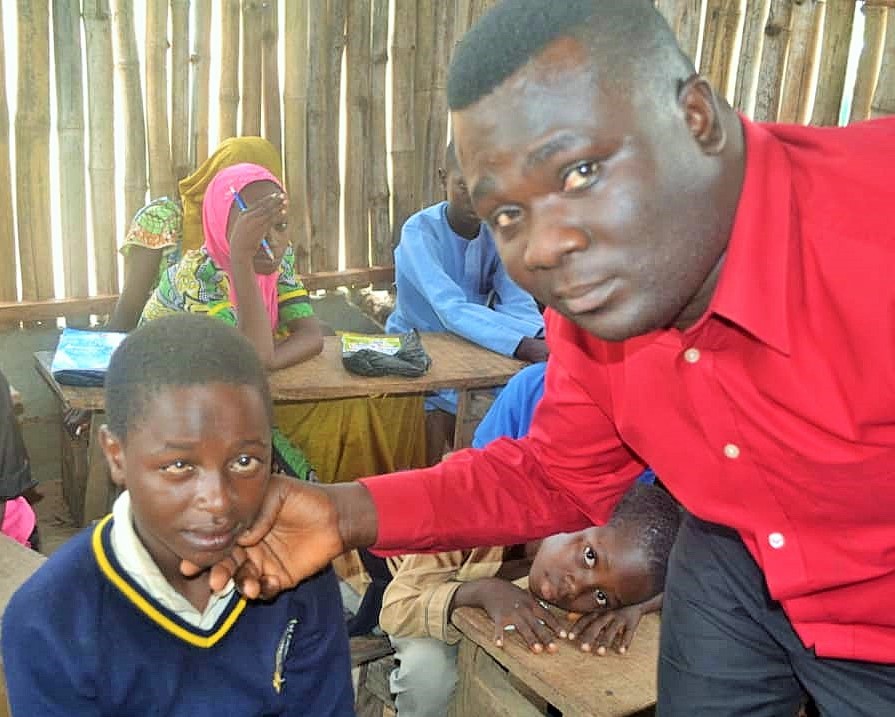 Ruga Children Are Going Blind Daily